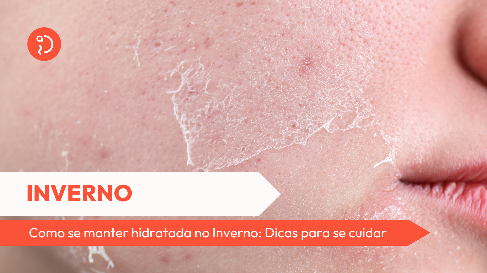 descubra como manter-se hidratada no inverno com dicas práticas de consumo de líquidos, alimentos ricos em água e cuidados com a pele para enfrentar os dias frios com saúde.